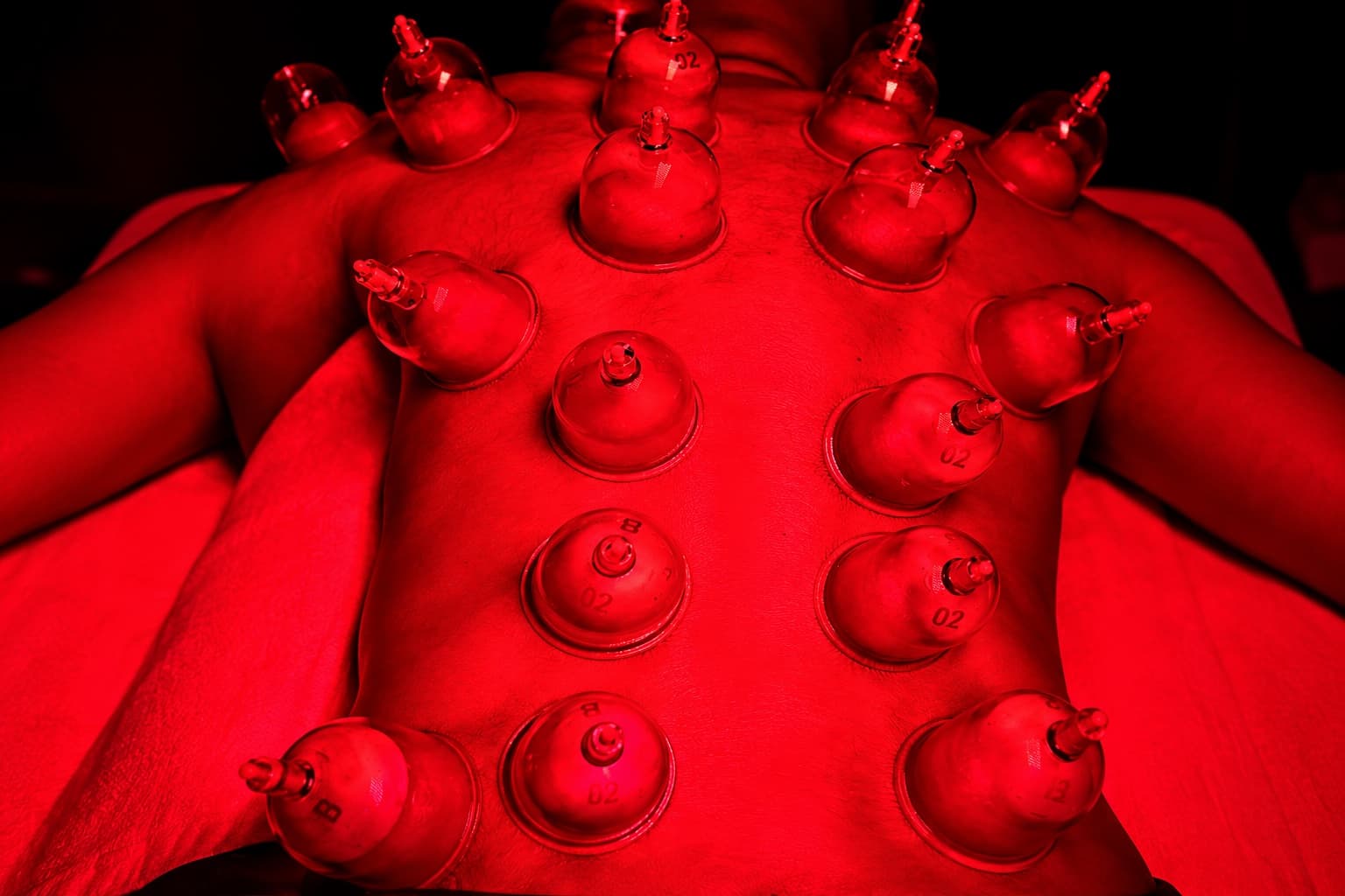 Lumino Cupping